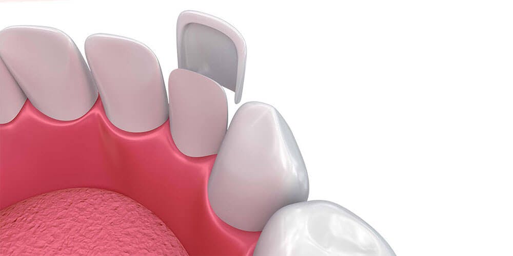 Fatete dentare Ploiesti