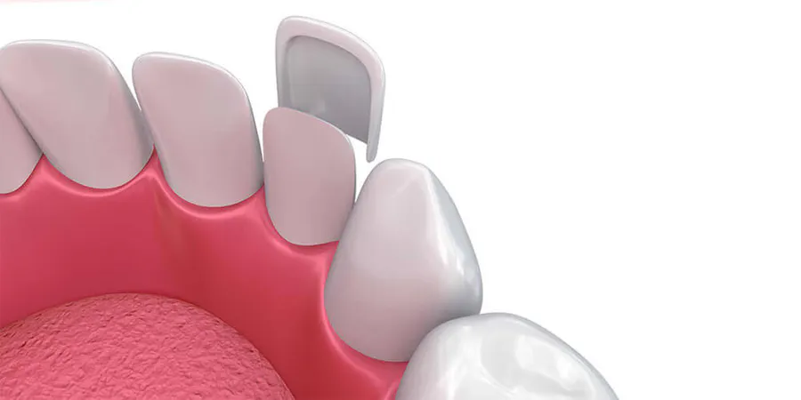 Fatete dentare Ploiesti